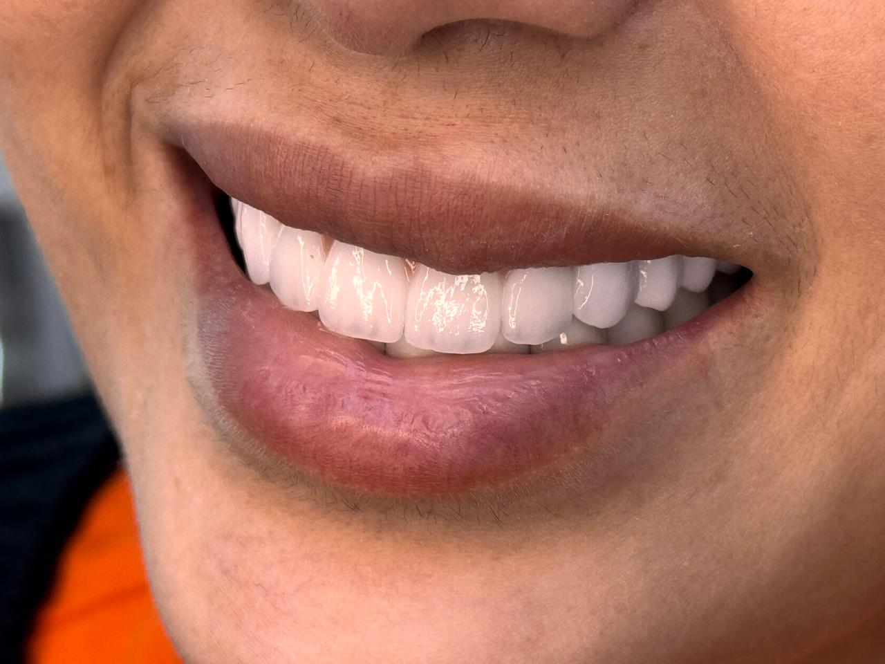 {{brizy_dc_image_alt imageSrc=