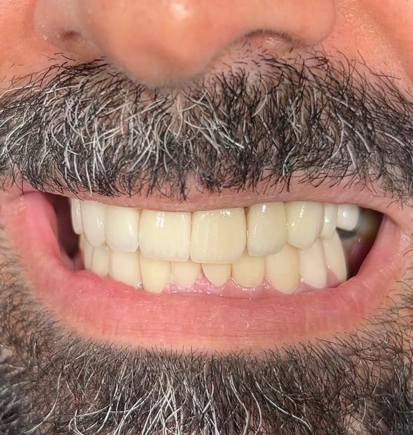 {{brizy_dc_image_alt imageSrc=