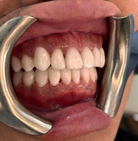 {{brizy_dc_image_alt imageSrc=