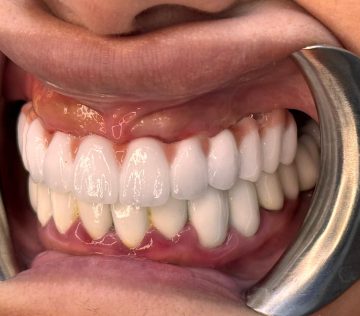 {{brizy_dc_image_alt imageSrc=