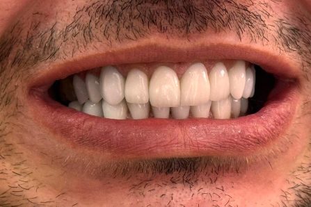 {{brizy_dc_image_alt imageSrc=