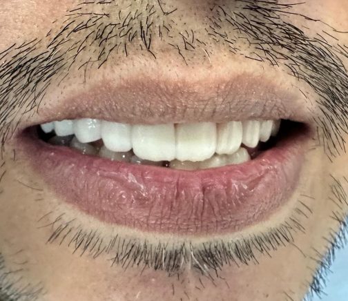 {{brizy_dc_image_alt imageSrc=