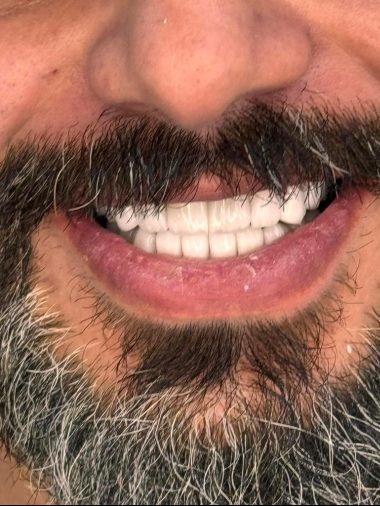 {{brizy_dc_image_alt imageSrc=