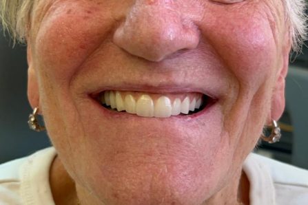 {{brizy_dc_image_alt imageSrc=