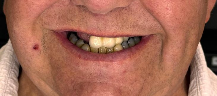 {{brizy_dc_image_alt imageSrc=