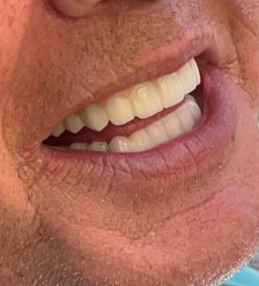 {{brizy_dc_image_alt imageSrc=