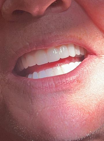 {{brizy_dc_image_alt imageSrc=