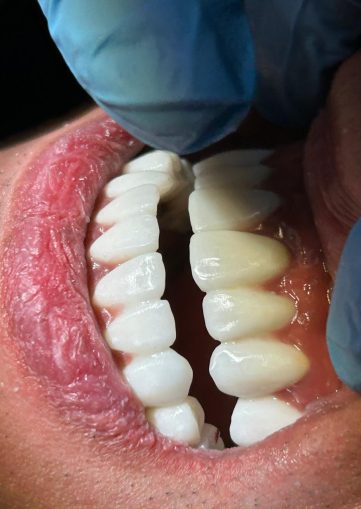 {{brizy_dc_image_alt imageSrc=